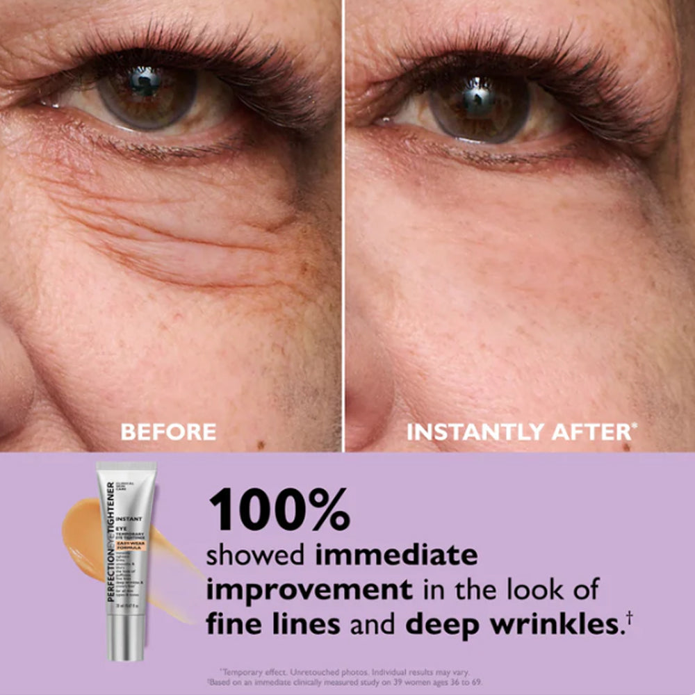 Sale Happening Now: Instant Eye Tightener