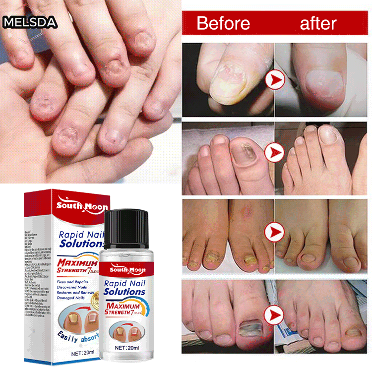 South Moon nail care essence serums