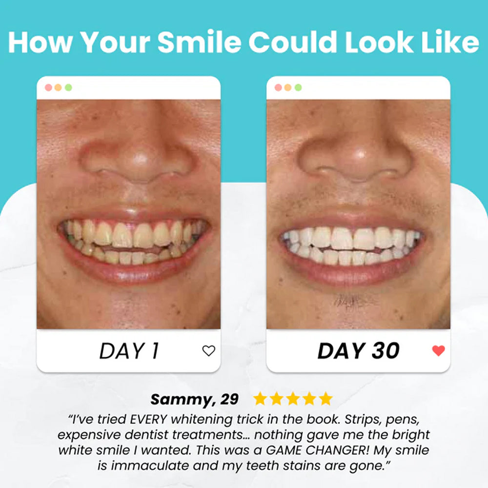 【BUY 1 GET 1 FREE】Brushing your teeth has never been simpler