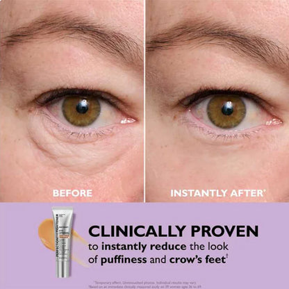 Sale Happening Now: Instant Eye Tightener