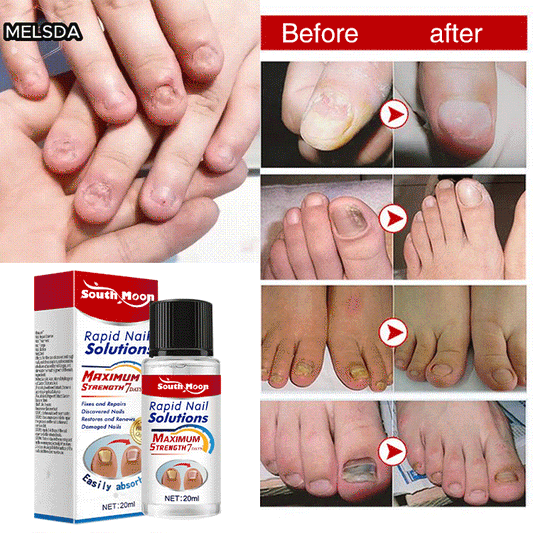 South Moon nail care essence serums